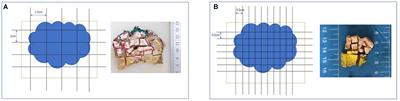 Multi-Site Tumour Sampling Improves the Detection of Intra-Tumour Heterogeneity in Oral and Oropharyngeal Squamous Cell Carcinoma